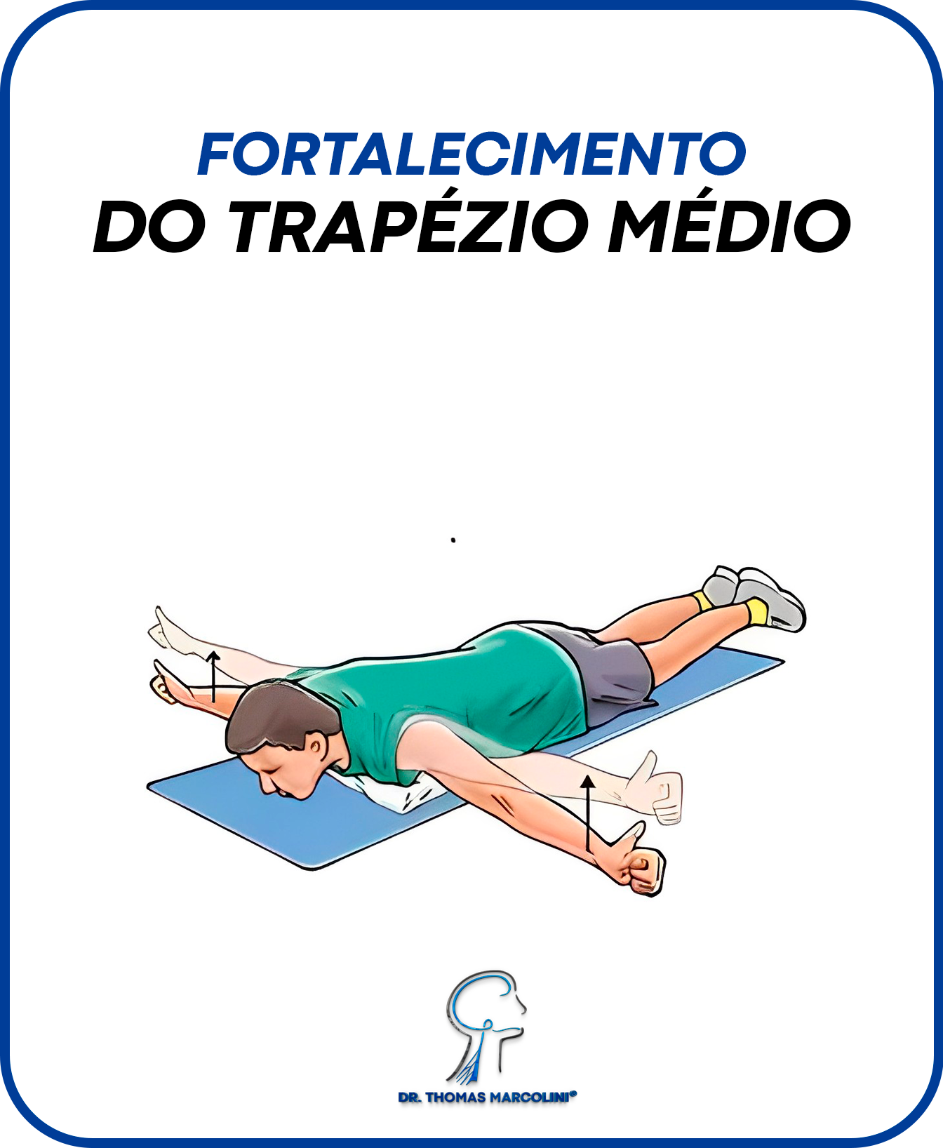 Fortalecimento de trapézio para alívio do desfiladeiro torácico.