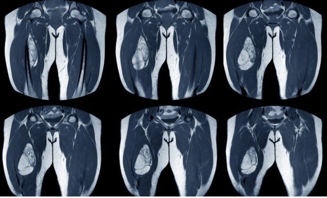 Radiologia para lesão de nervos periféricos.