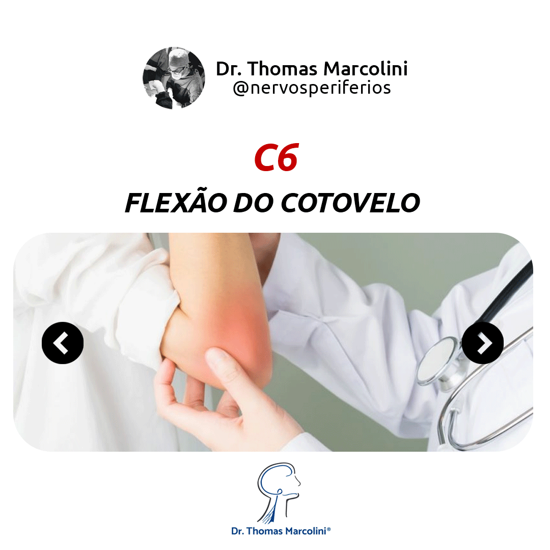 Médico examinando cotovelo de paciente com dor destacada, ilustrando a função da raiz C6 do plexo braquial
