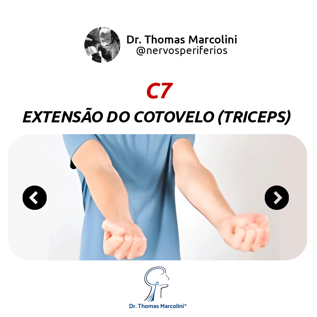 Braços estendidos com punhos fechados, ilustrando extensão do cotovelo pela função da raiz C7 do plexo braquial