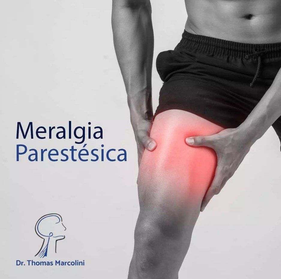 Médico Neurocirurgião Especialista em Meralgia Parestésica o que é? Médico Neurocirurgião Especialista em Meralgia Parestésica