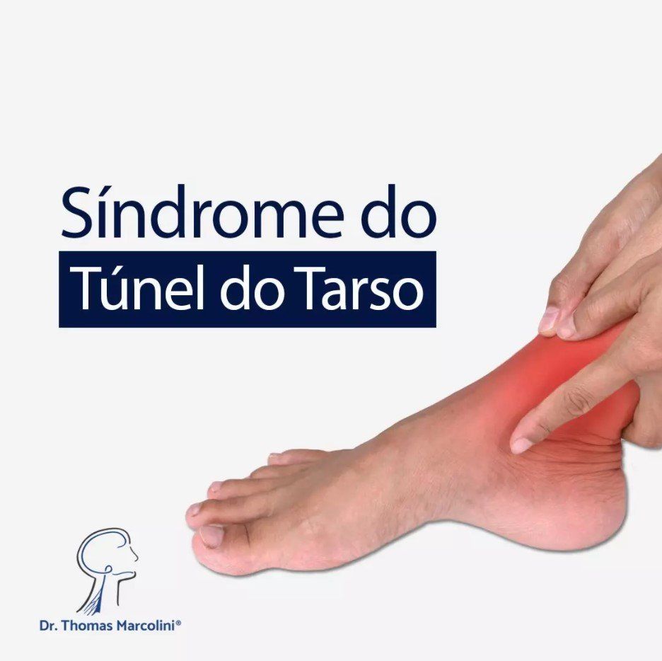 Médico Especialista em Síndrome do Túnel do Tarso