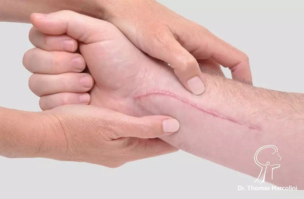 Médico Neurocirurgião especializado em Neuroma Doloroso Médico Neurocirurgião especializado em Neuroma