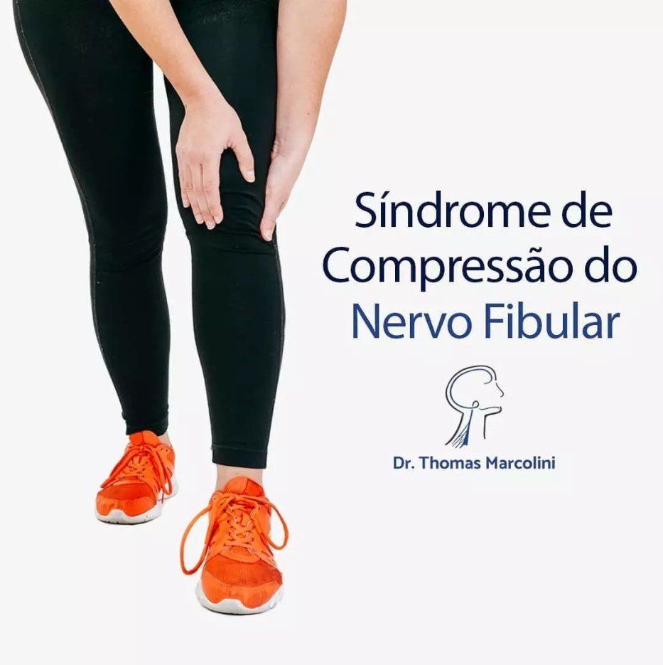 Médico Especialista em Neuropatia do Nervo Fibular e do pé Médico Especialista em Compressão do Nervo Fibular