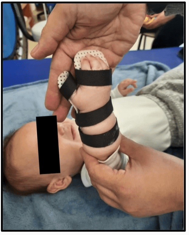 Médico que trata lesão de plexo braquial obstétrica (ao nascimento)