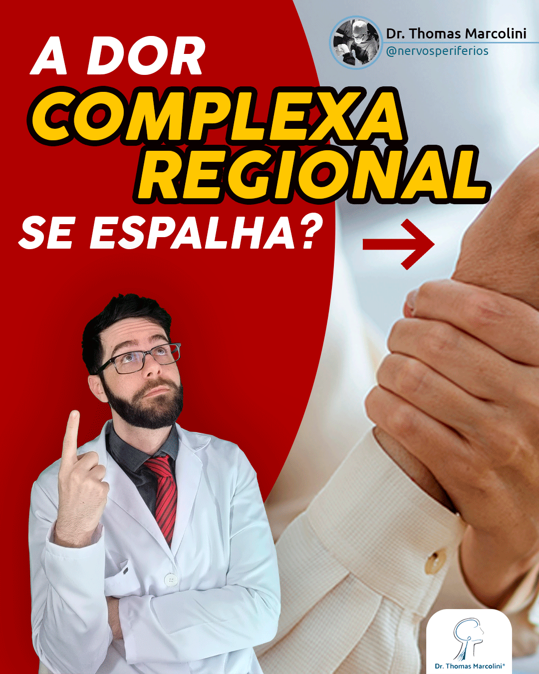 Dr. Thomas Marcolini explica se a dor complexa regional pode se espalhar pelo corpo