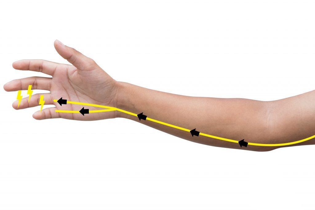 Ilustração do braço com setas amarelas mostrando o fluxo normal de energia do nervo ulnar até a mão