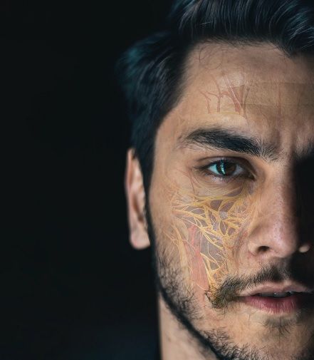 Rosto de homem com ilustração digital de trajeto nervoso sobreposta, representando o diagnóstico da paralisia facial