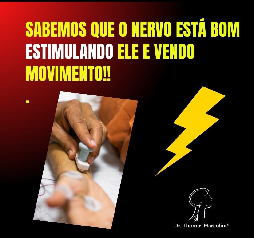 Mão segurando neuroestimulador com ilustração de raio, com o texto