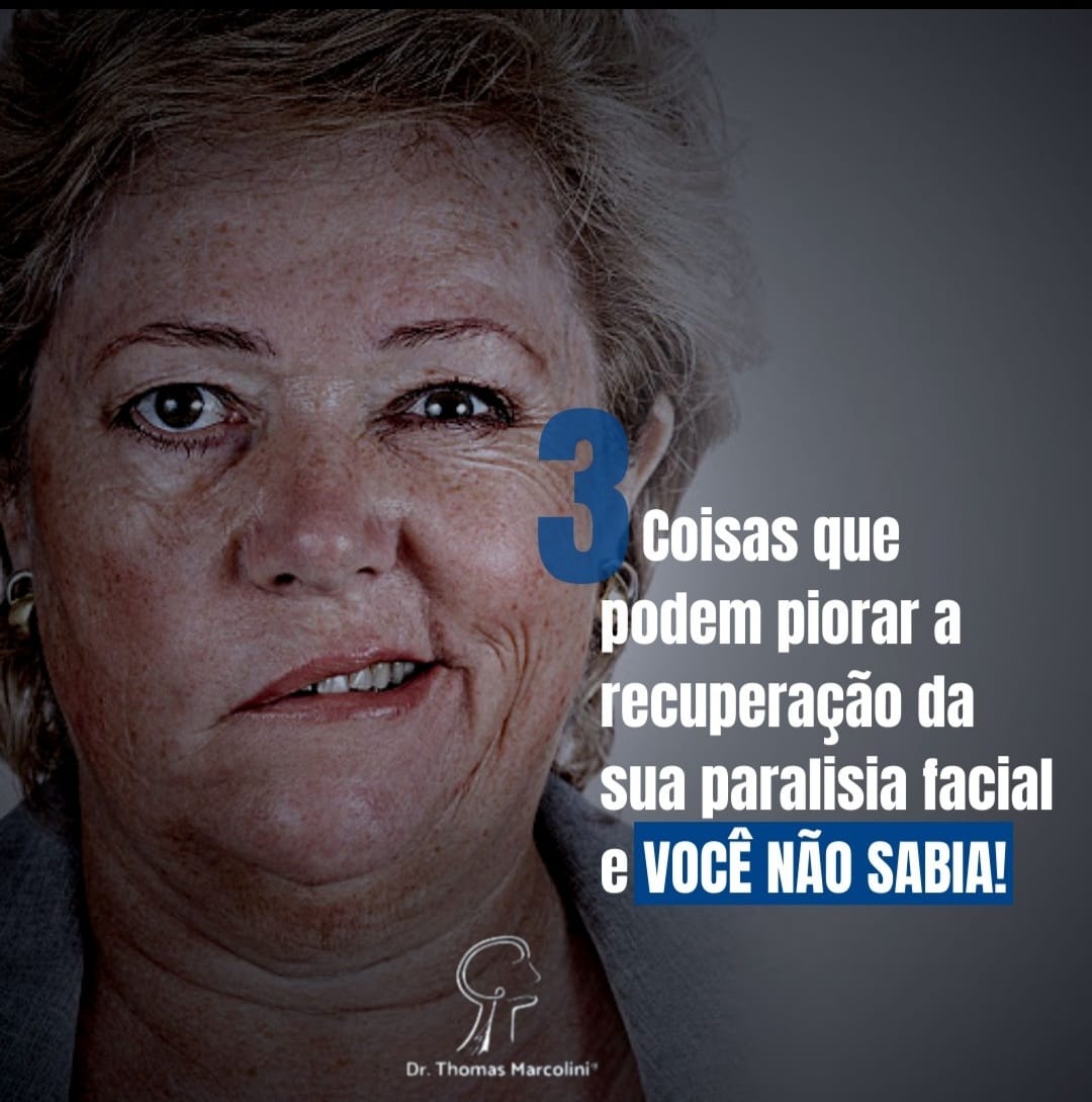 3 Exercícios que pioram a paralisia facial de Bell 3 Exercícios Que Estão Piorando Sua Paralisia Facial!! Fisioterapia, O Que Não Fazer Em 2023!!