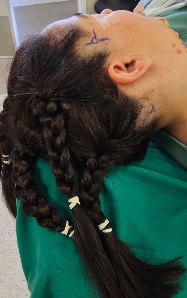 cirurgia para dor de cabeça