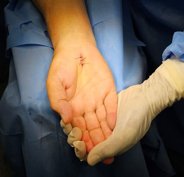 médico que faz cirurgia do túnel do carpo