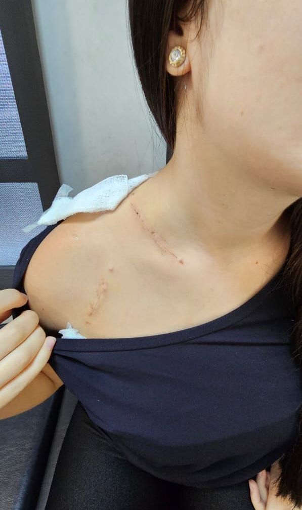 médico especialista em síndrome do desfiladeiro torácico