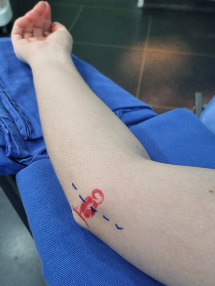 médico especialista em nervo ulnar