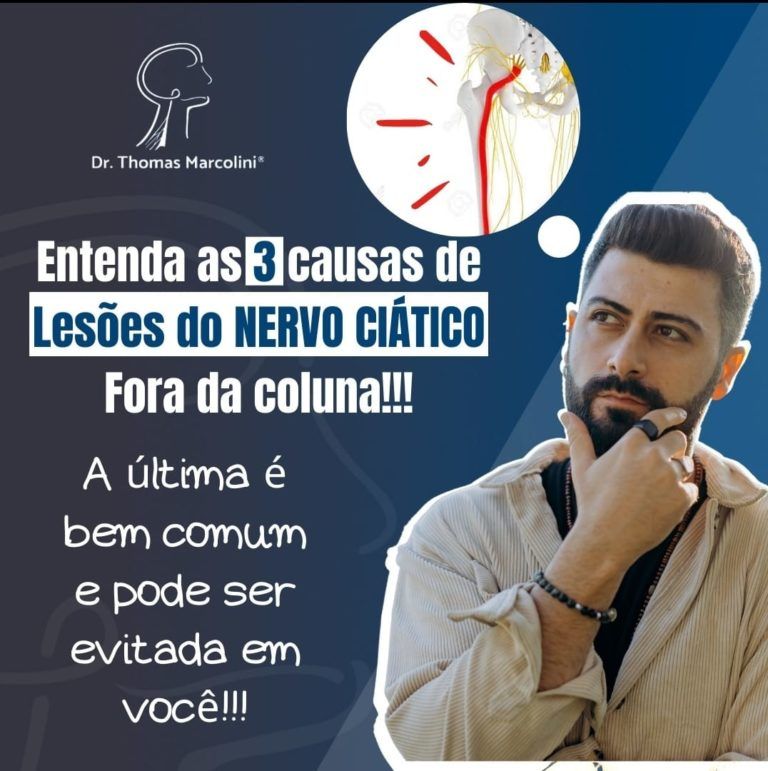 Lesão Do Nervo Ciático Fora Da Coluna Lesão Do Nervo Ciático Fora Da Coluna – Como Evitar Em 2022!
