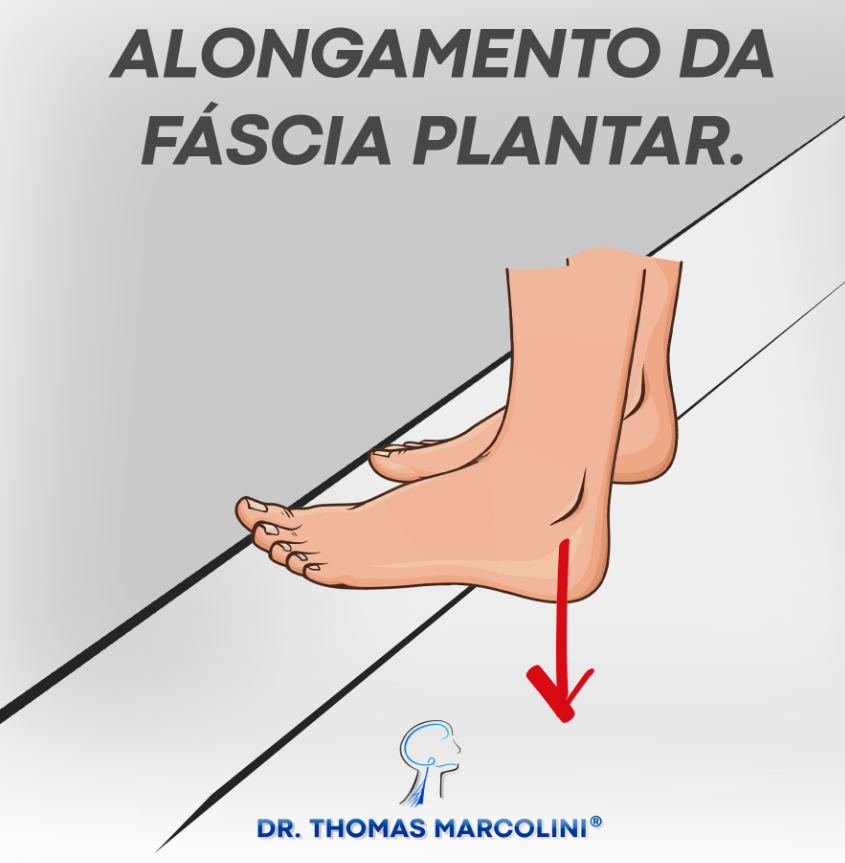 Ilustração de pé alongando a fáscia plantar em uma borda, exercício para pé caído e equino