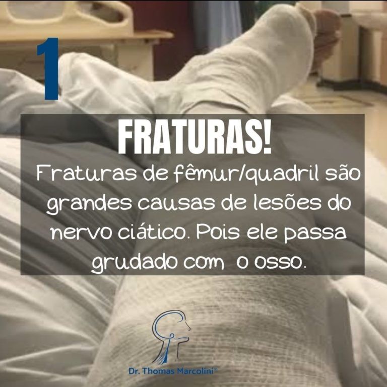 Fraturas de fêmur e quadril Fraturas de fêmur e quadril lesiona o ciático