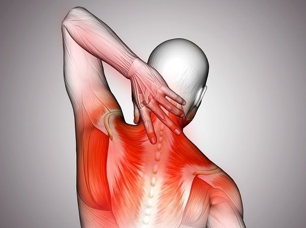 Ilustração anatômica dos músculos do pescoço e ombro destacados em vermelho, alongamento para aliviar o desfiladeiro torácico