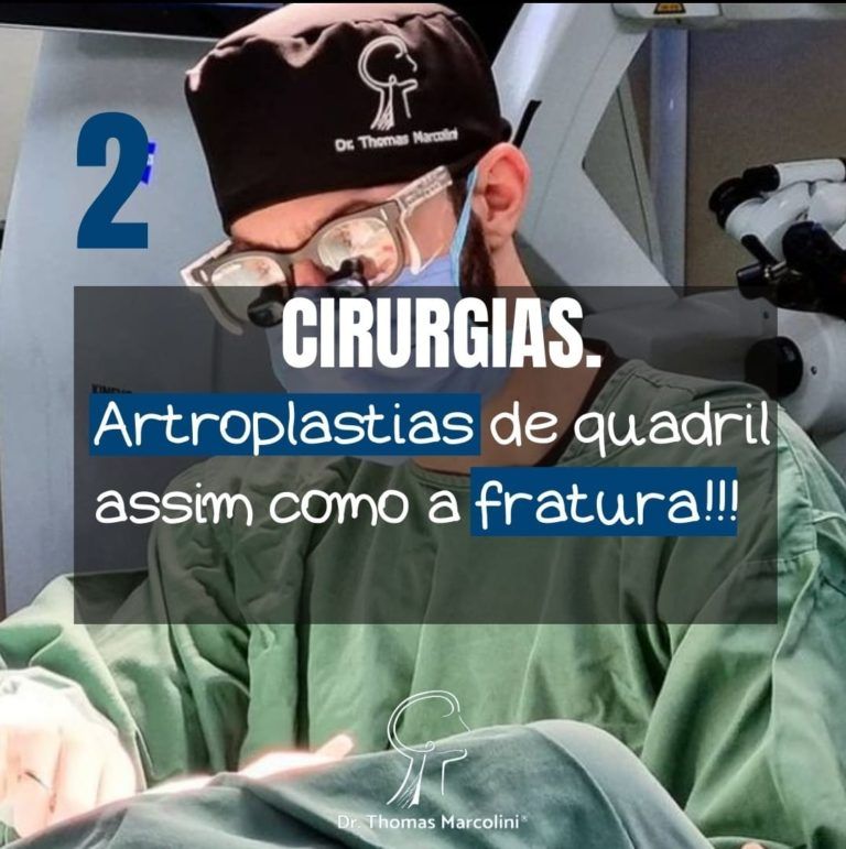 Astroplastias de quadril lesionam o nervo Astroplastias de quadril