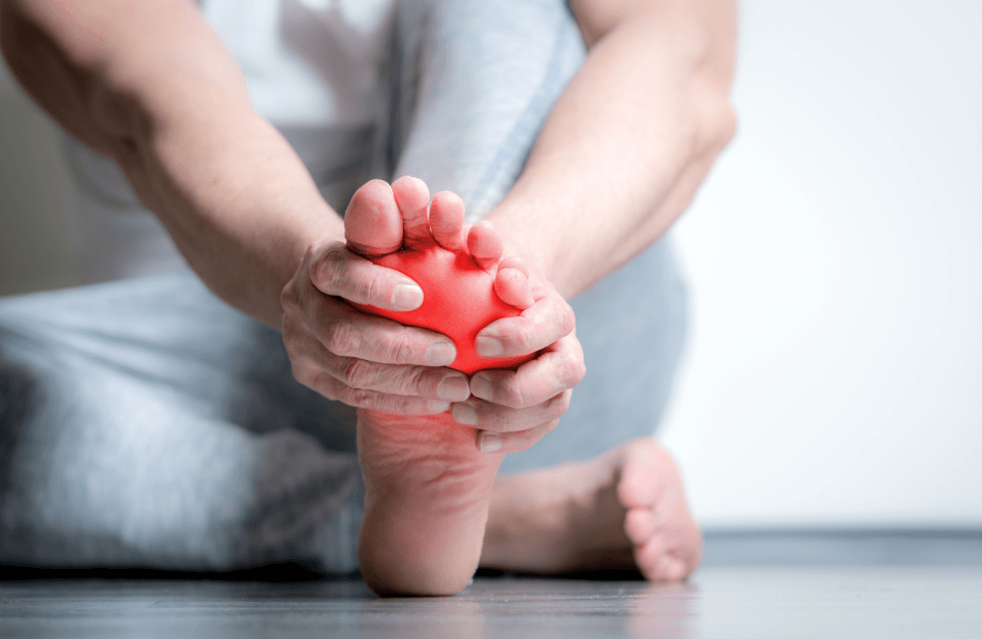 Pessoa segurando a sola do pé com a região dolorida destacada em vermelho, local típico da dor do neuroma de Morton