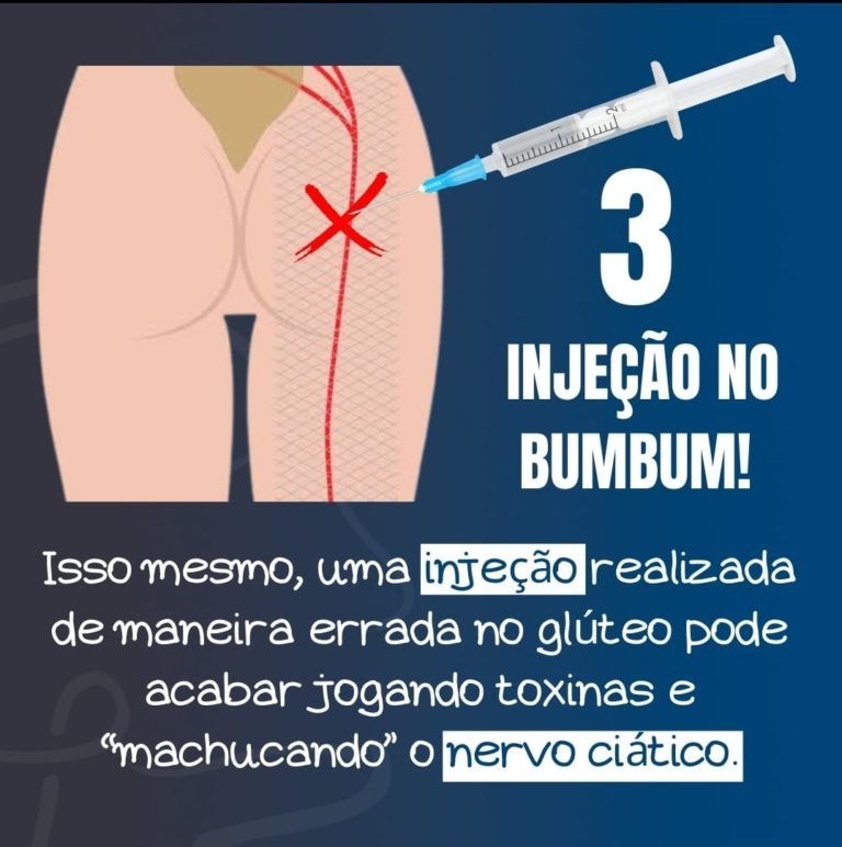 Injeção aplicada de maneira errada lesionam o nervo e causa pé caído Injeção aplicada de maneira erronêa