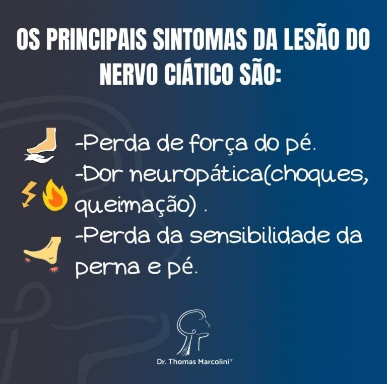 principais sintomas da lesão do pé caído principais sintomas da lesão do nervo ciático