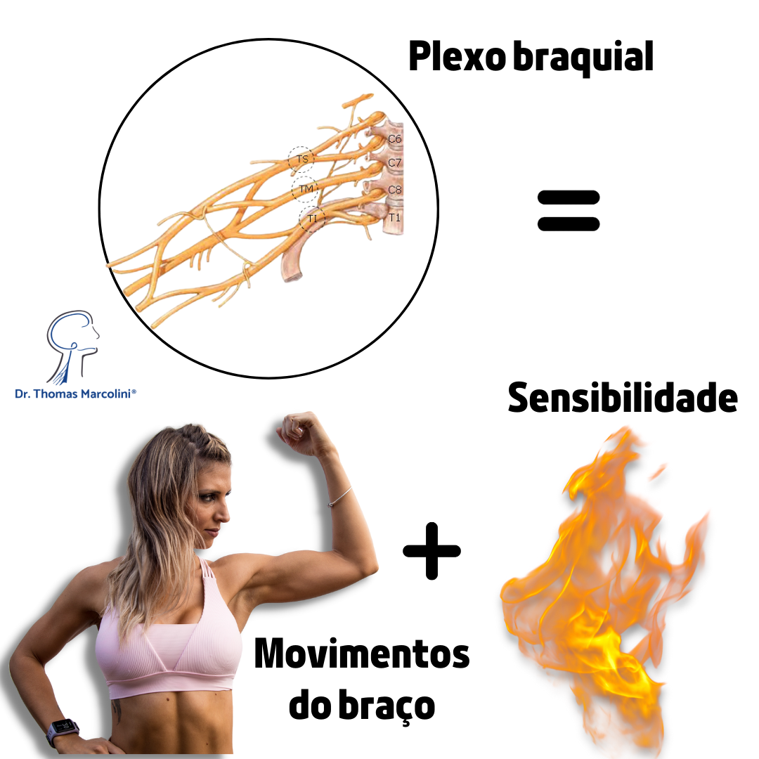 Ilustração dos nervos do plexo braquial ao lado da palavra 