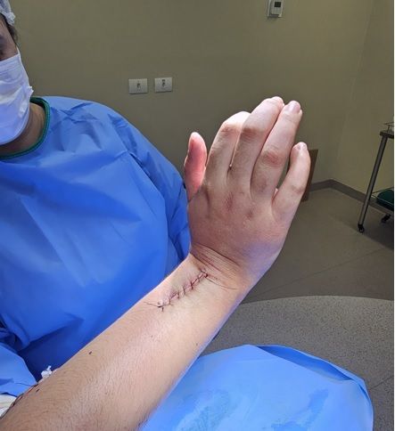 Médico que trata Lesão do Nervo Radial