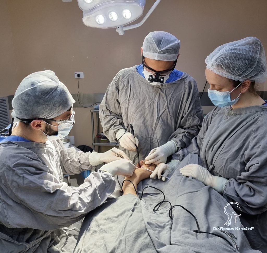 Tratamentos para o Neuroma de Morton com médico especialista dr. thomas marcolini Tratamento para Neuroma de Morton com médico especialista