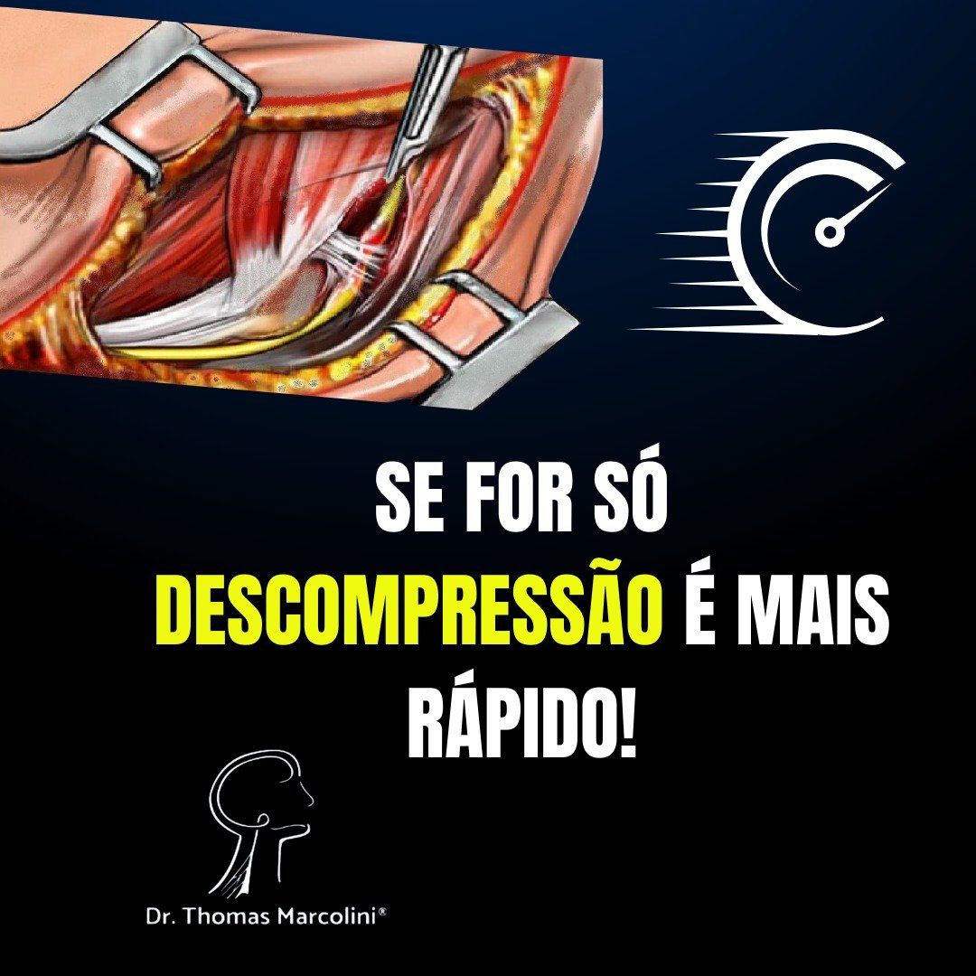 Tempo de regeneração de um nervo lesionado. Tempo de recuperação do nervo após descompressão.
