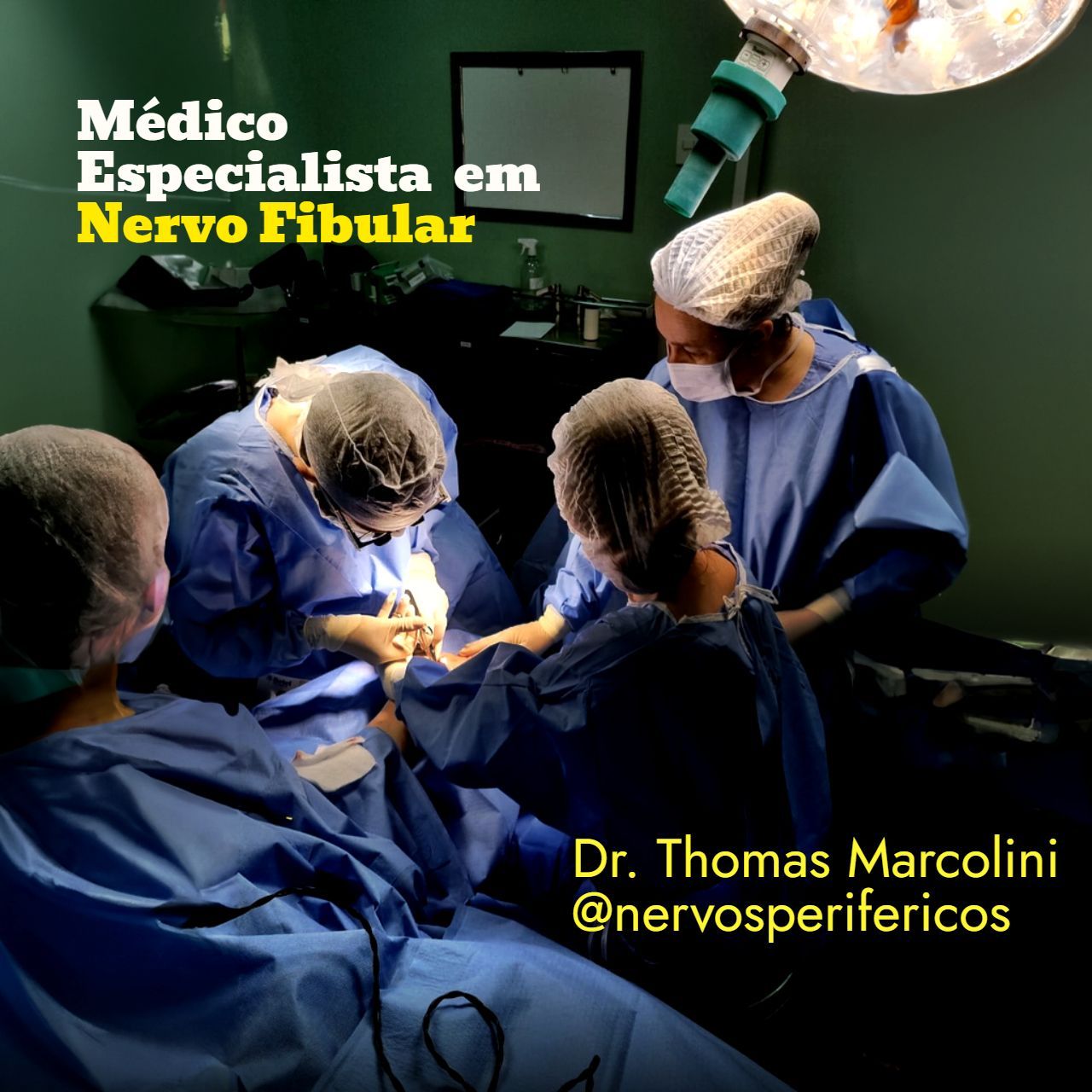Dr. Thomas Marcolini e equipe cirúrgica operando, especialistas em nervo fibular e síndrome do pé caído