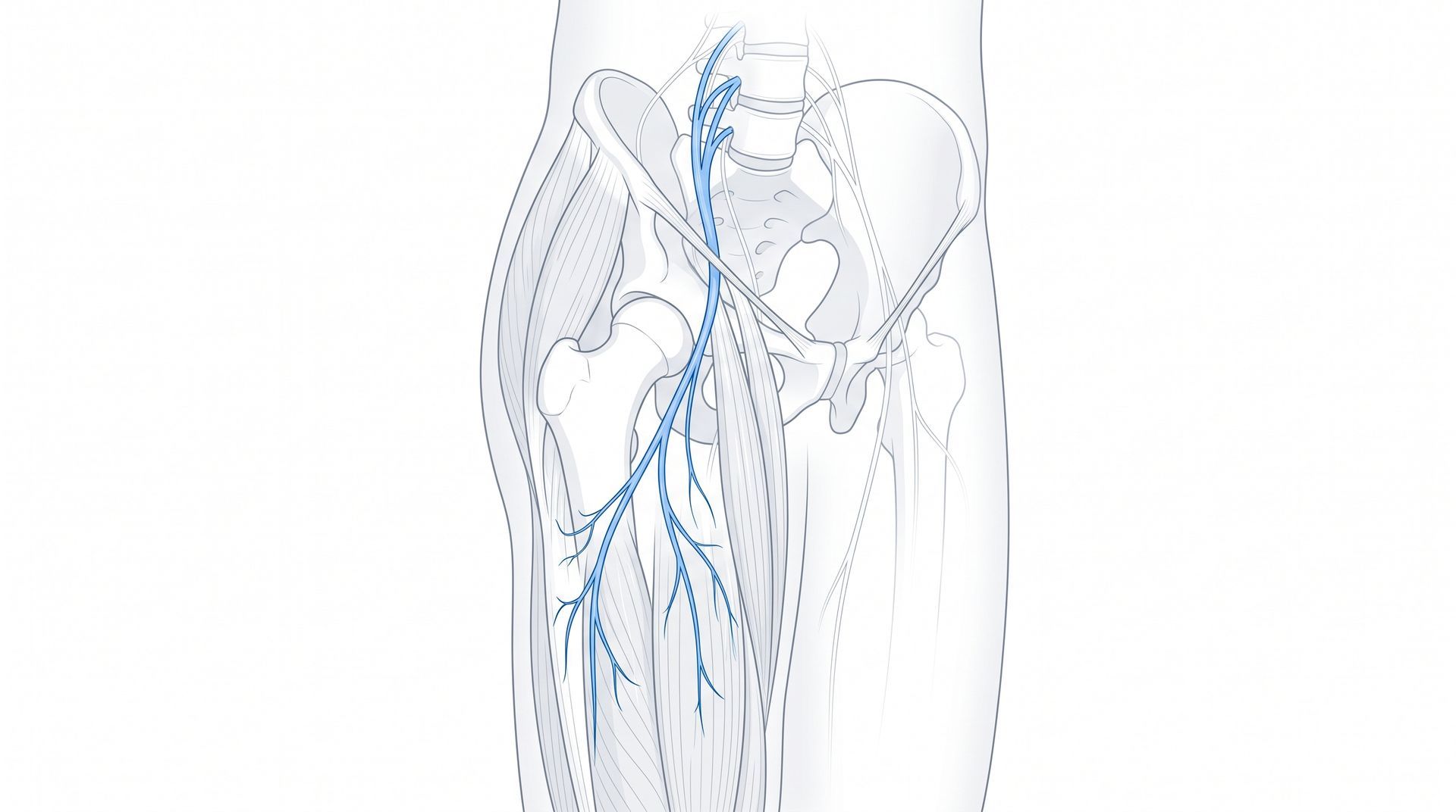 Trajeto do nervo cutâneo femoral lateral na parte externa da coxa