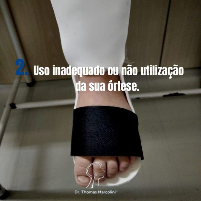 Uso inadequado ou não utilização da sua órtese Uso inadequado ou não utilização da sua órtese