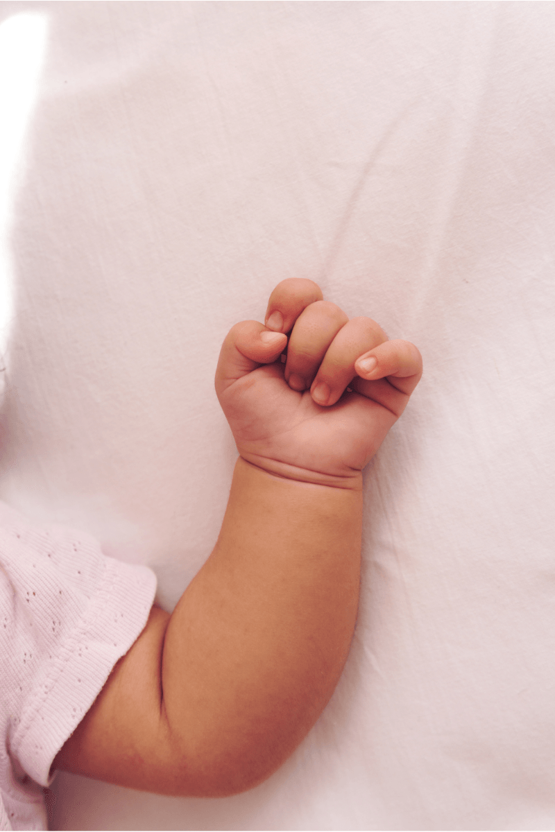 Quais os sintomas de lesão do plexo braquial em bebês?