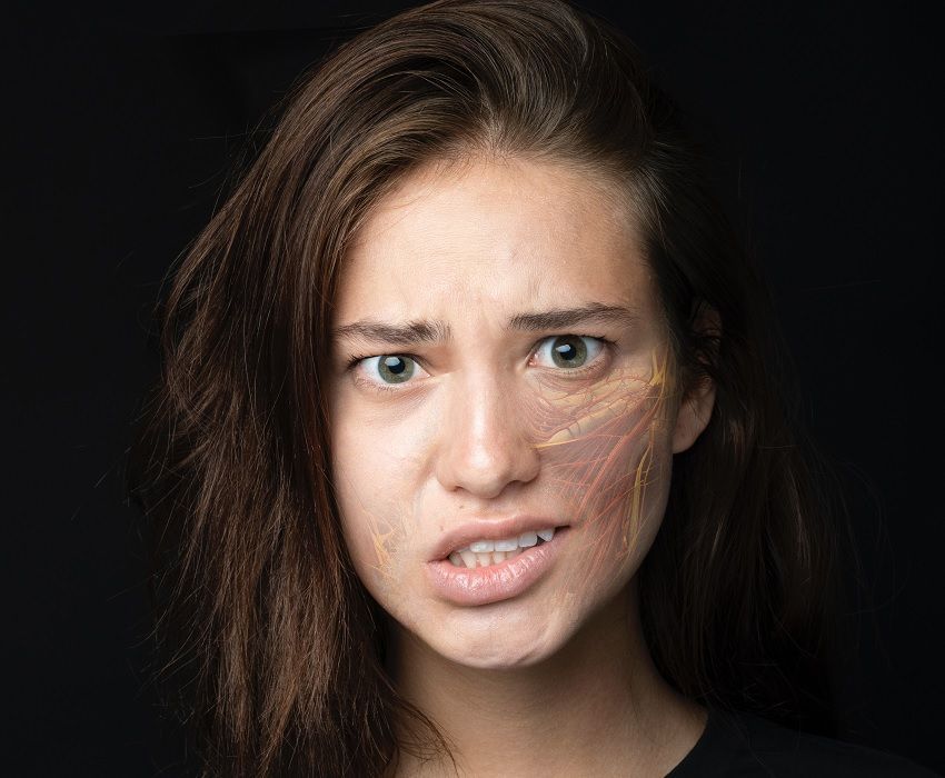 Mulher com expressão de susto e assimetria facial, sintoma de início da paralisia facial