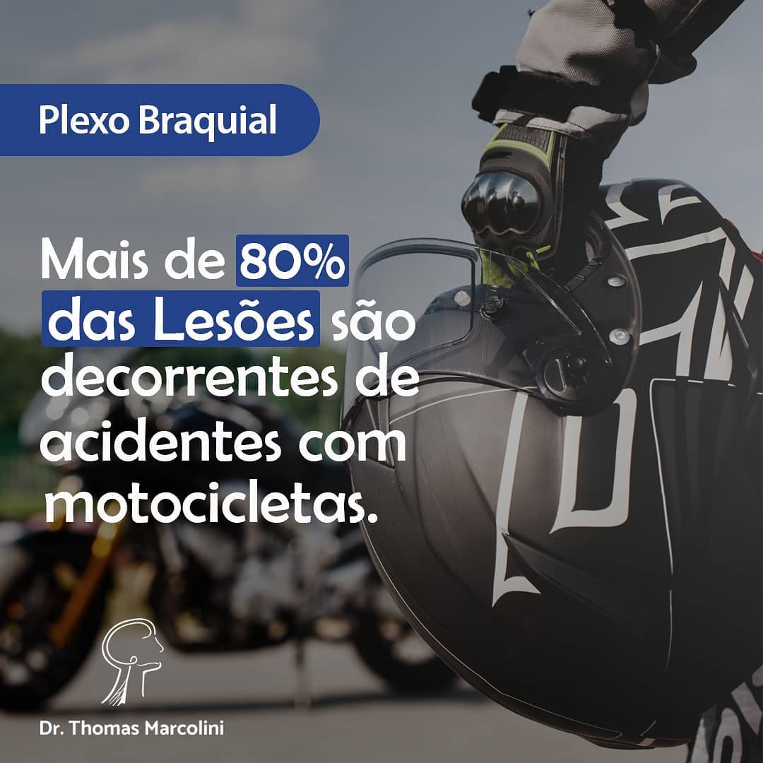 Plexo braquial e as motocicletas Plexo braquial causada por queda de moto