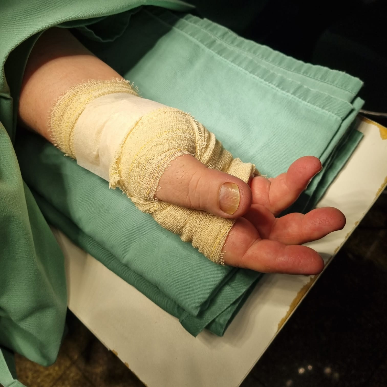 como é a recuperação da cirurgia de síndrome do túnel do carpo? como é a recuperação da cirurgia de túnel do carpo?