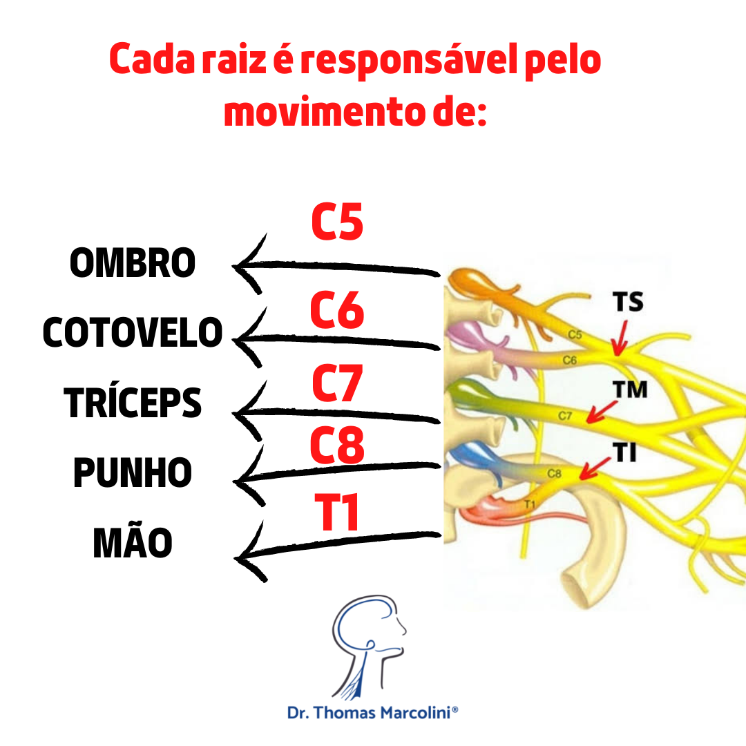 Diagrama das raízes nervosas C5 a T1 do plexo braquial e seus movimentos correspondentes: ombro, cotovelo, tríceps, punho e mão