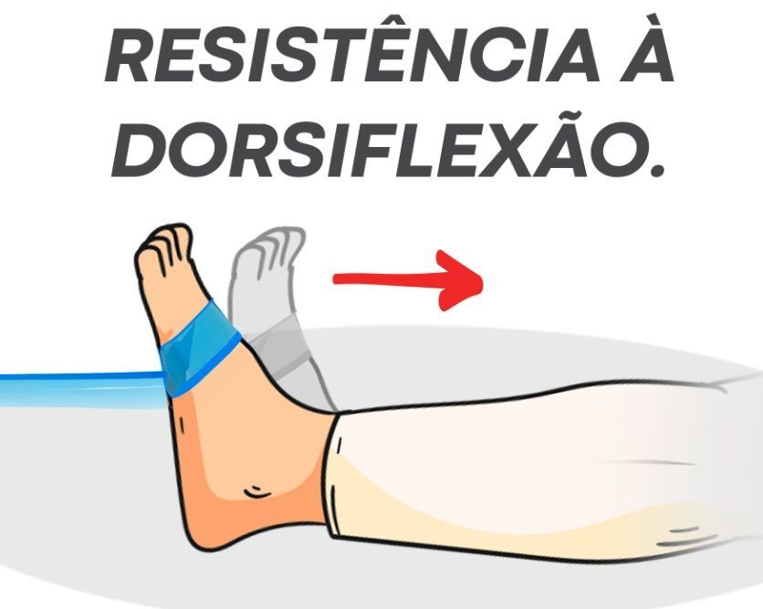 Ilustração de pé com faixa elástica fazendo dorsiflexão contra resistência, exercício de fortalecimento para pé caído