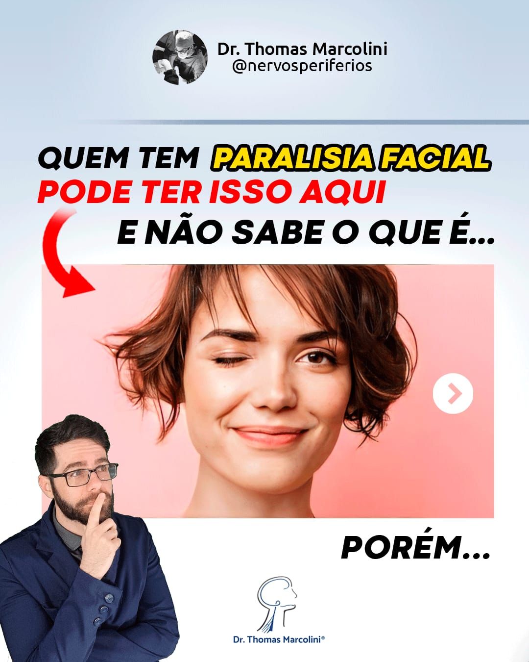 Dr. Thomas Marcolini explica quem tem paralisia facial pode desenvolver sincinesia