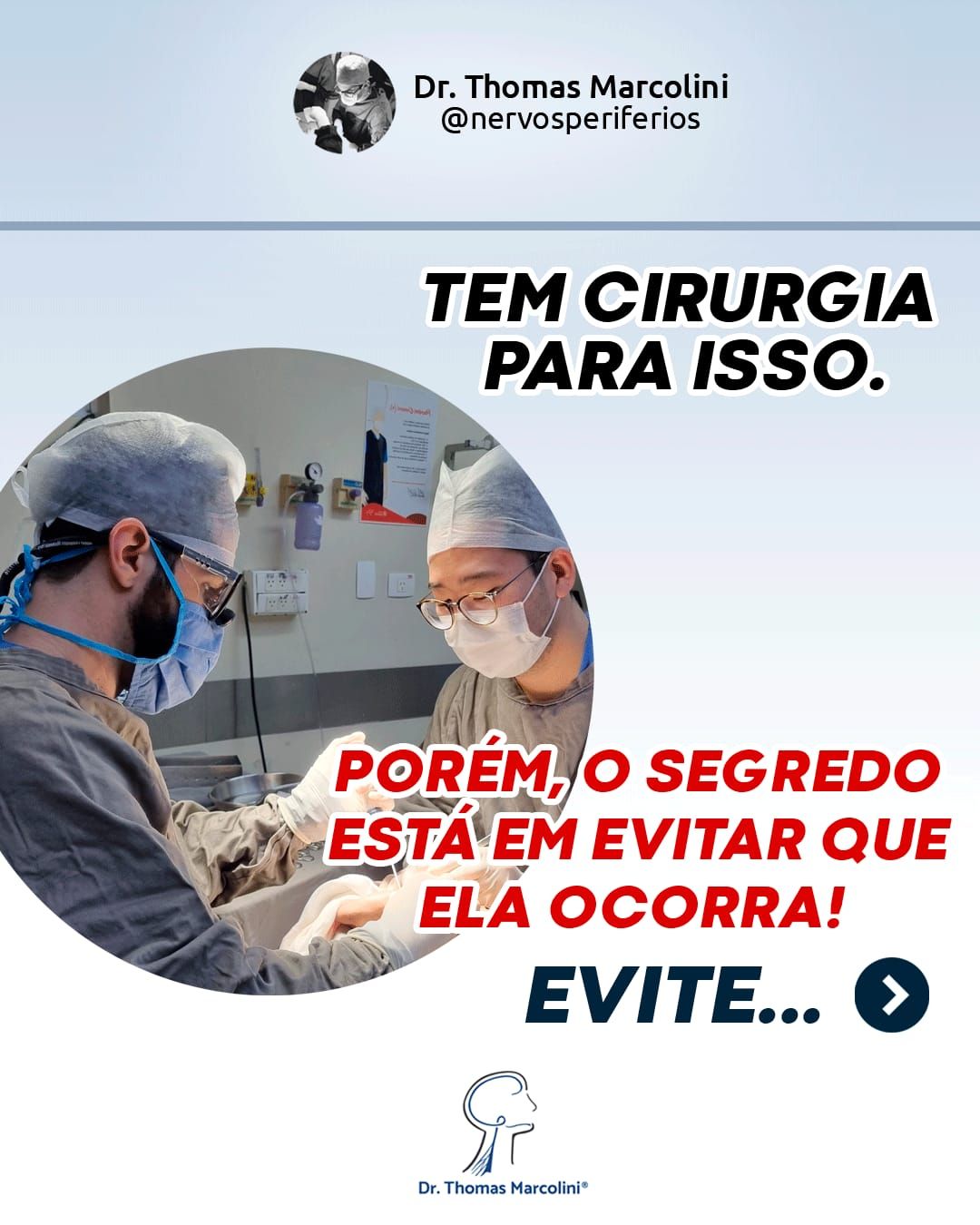 Dr. Thomas Marcolini e equipe cirúrgica, tratamento cirúrgico disponível para sincinesia