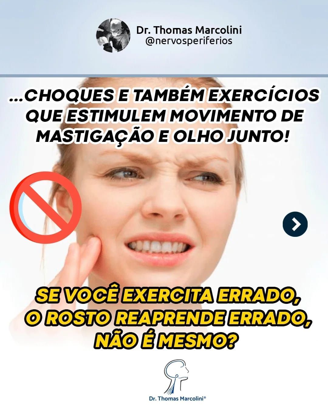 Dr. Thomas Marcolini explica exercícios e estímulos para evitar a sincinesia após paralisia facial