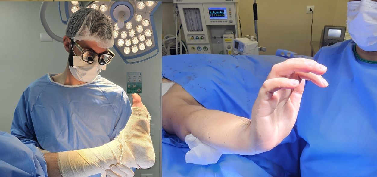 Médico especialista em cirurgião de tendões para mão e pé caído.