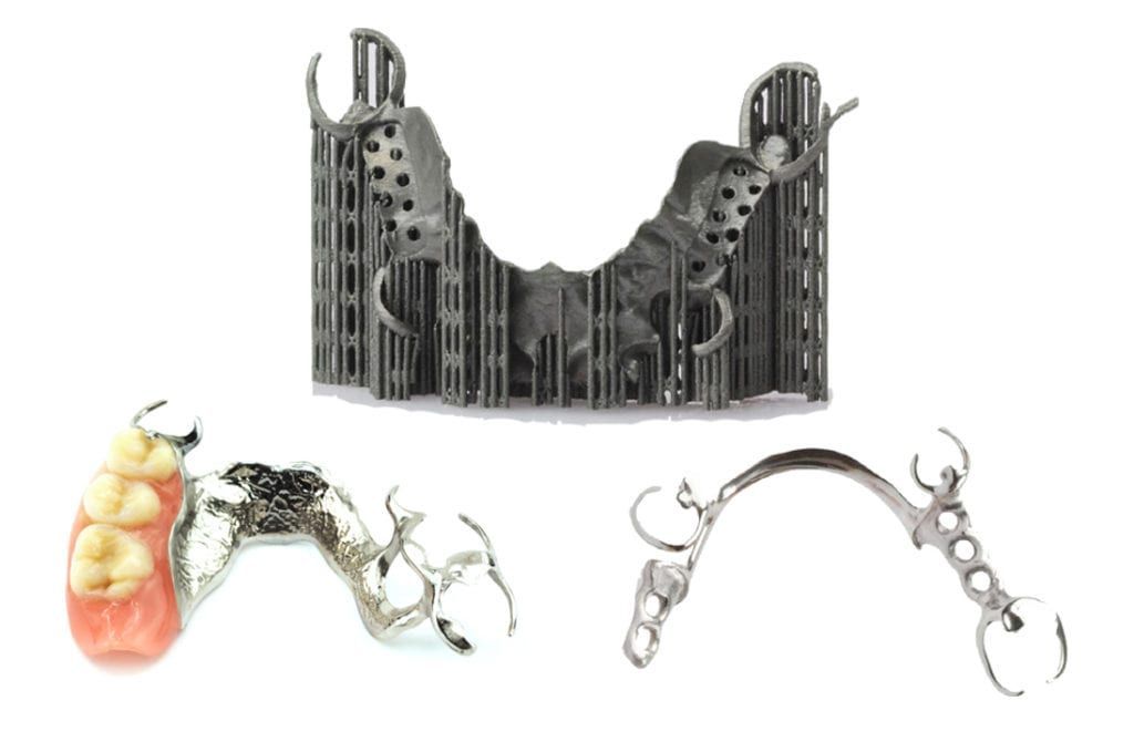 Three dental partial dentures on white background: framework, and two with teeth.
