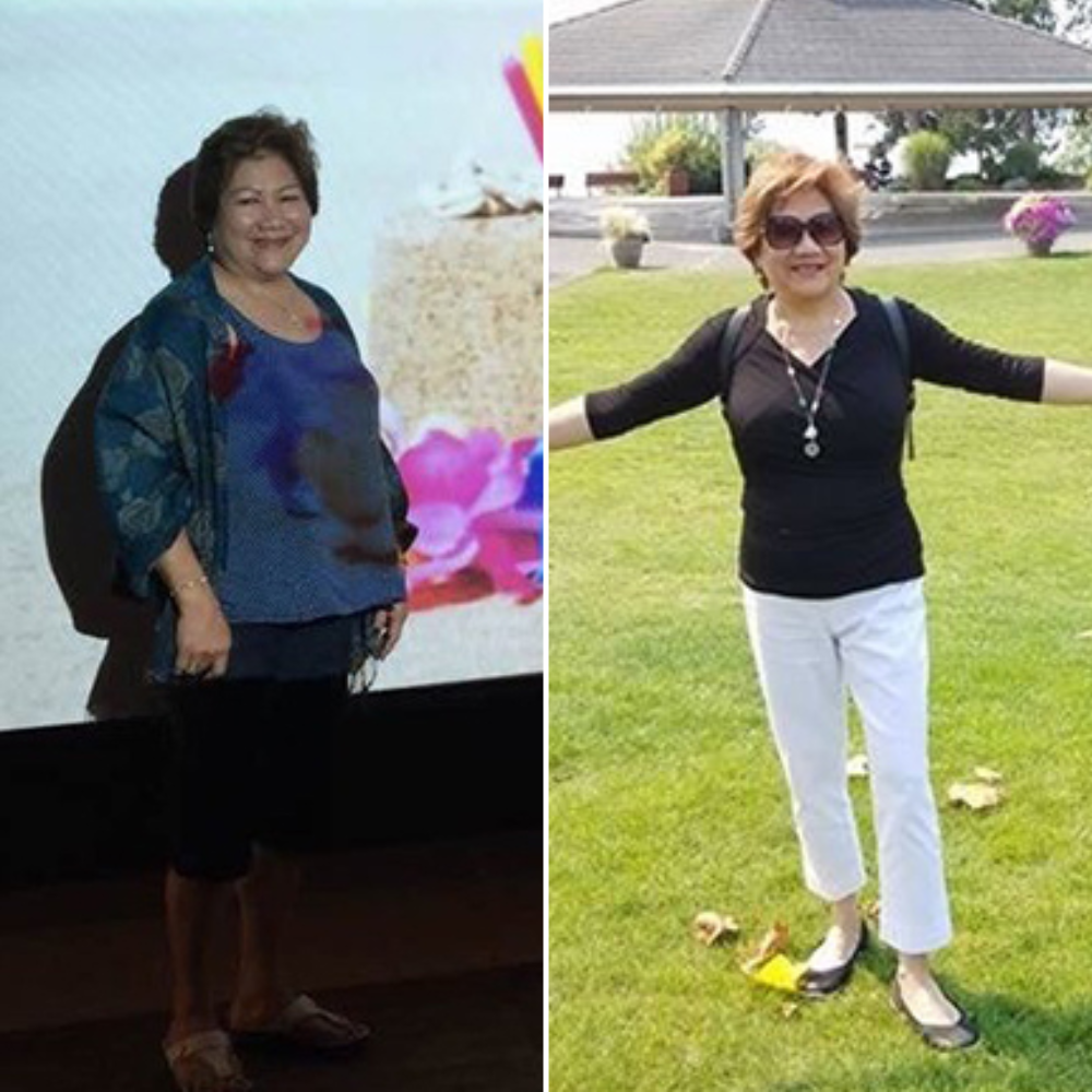 Woman before and after weight loss, in casual clothes, smiling outside.