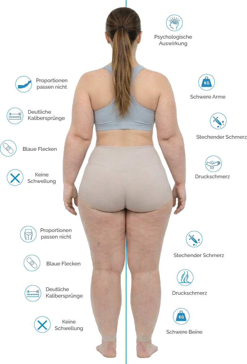 Informationsgrafik über wesentliche Lipödem-Symptome