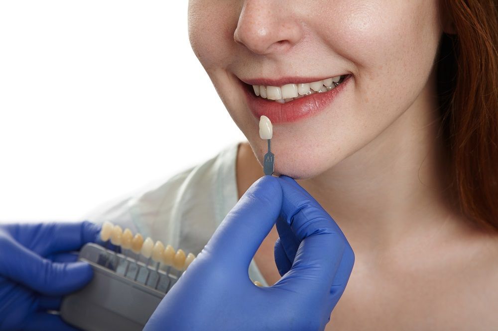 Porcelain Veneers