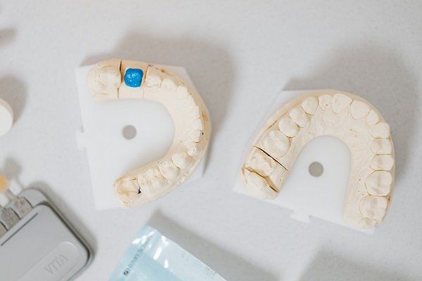 Porcelain Veneers & Laminates Lake Mary