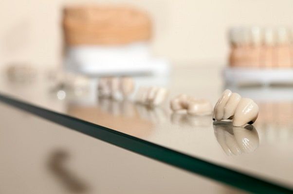 What Is the Average Life Expectancy of a Dental Crown?