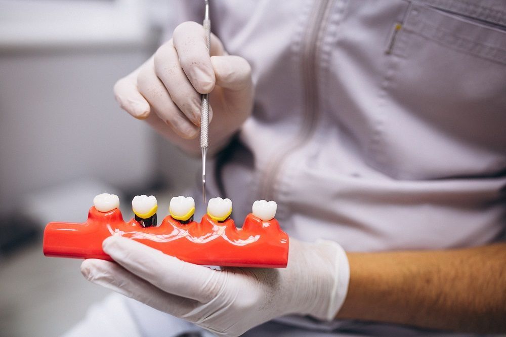 Dental Crown